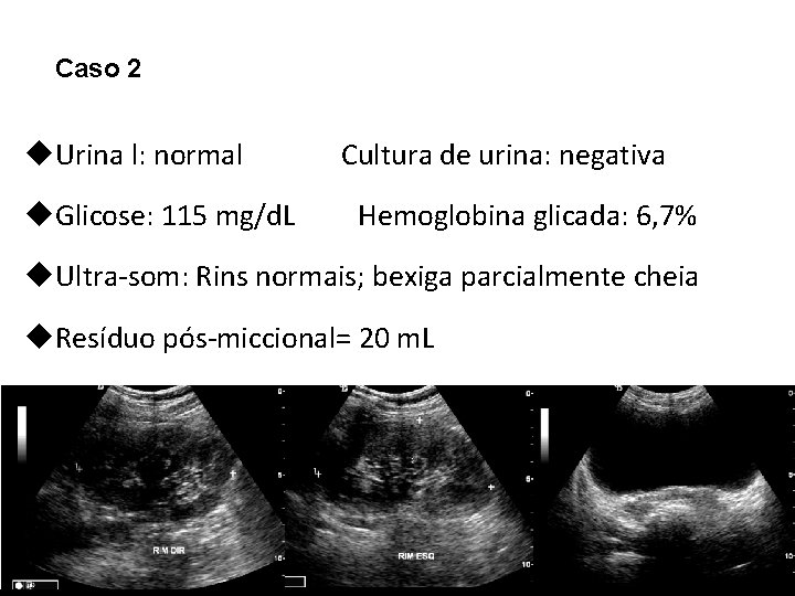 Caso 2 u. Urina l: normal u. Glicose: 115 mg/d. L Cultura de urina: