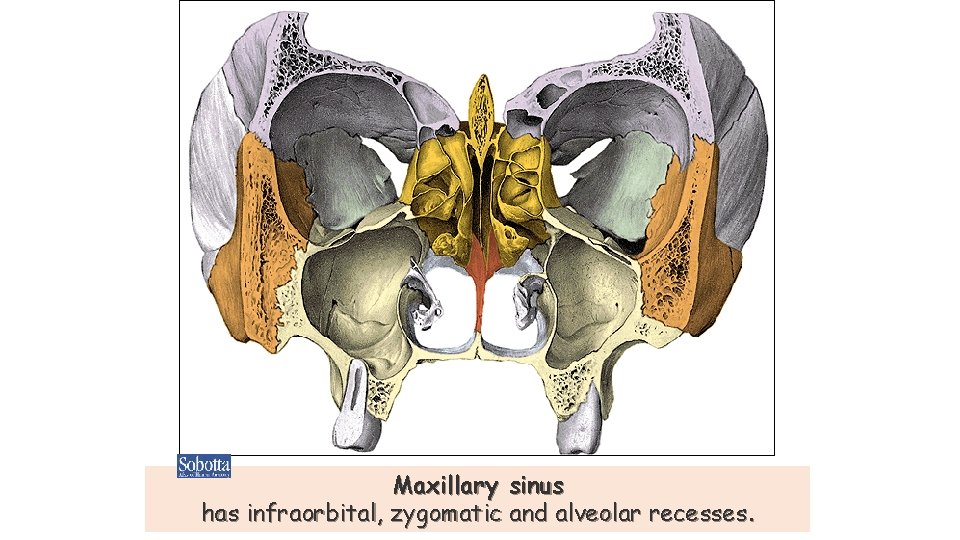 Maxillary sinus has infraorbital, zygomatic and alveolar recesses. Maxillary sinus has infraorbital, zygomatic and alveolar recesses.