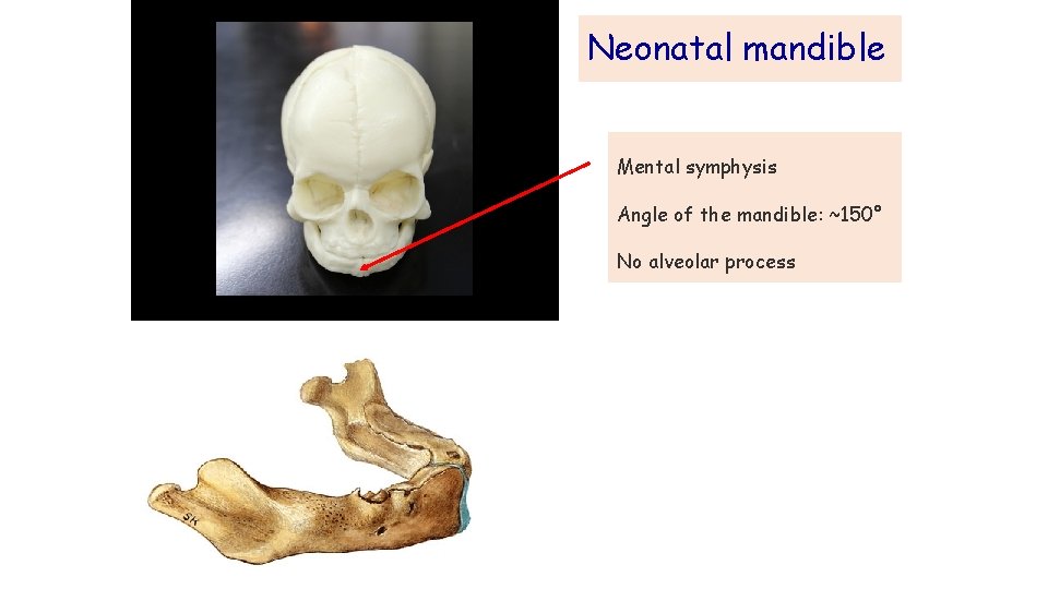 Neonatal mandible Mental symphysis Angle of the mandible: ~150° No alveolar process 