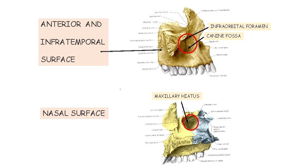 ANTERIOR AND INFRAORBITAL FORAMEN CANINE FOSSA INFRATEMPORAL SURFACE MAXILLARY HIATUS NASAL SURFACE 