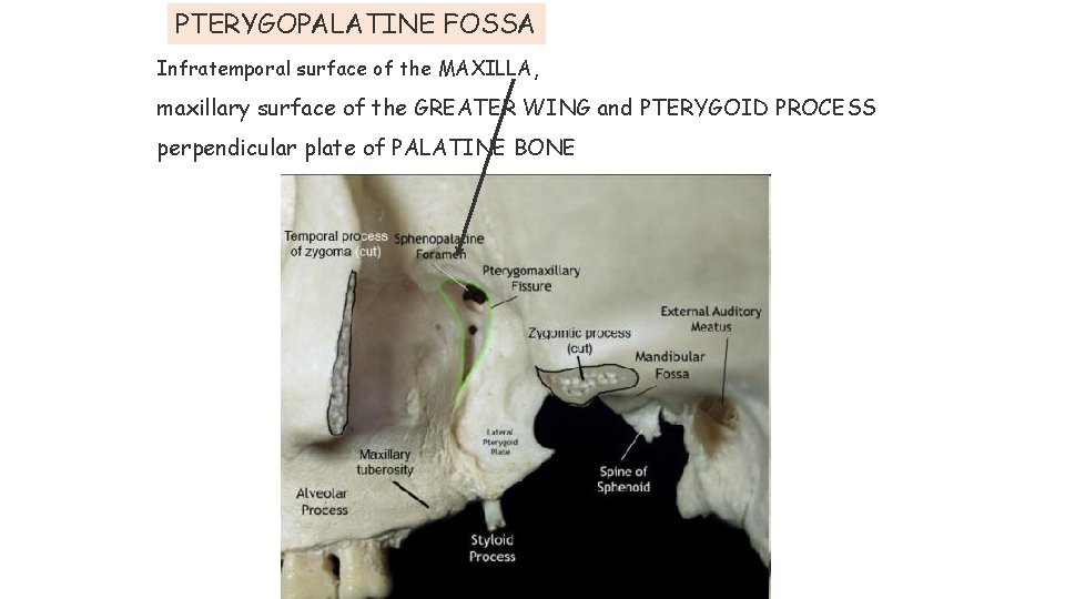 PTERYGOPALATINE FOSSA Infratemporal surface of the MAXILLA, maxillary surface of the GREATER WING and