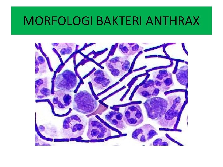 MORFOLOGI BAKTERI ANTHRAX 