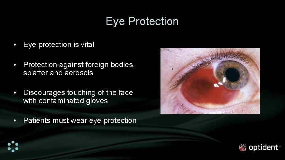 Eye Protection • Eye protection is vital • Protection against foreign bodies, splatter and