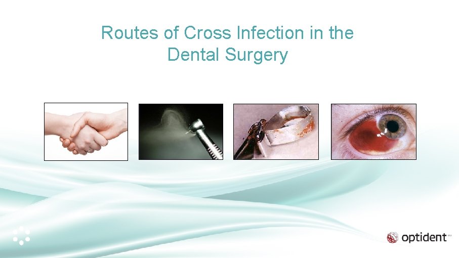 Routes of Cross Infection in the Dental Surgery 