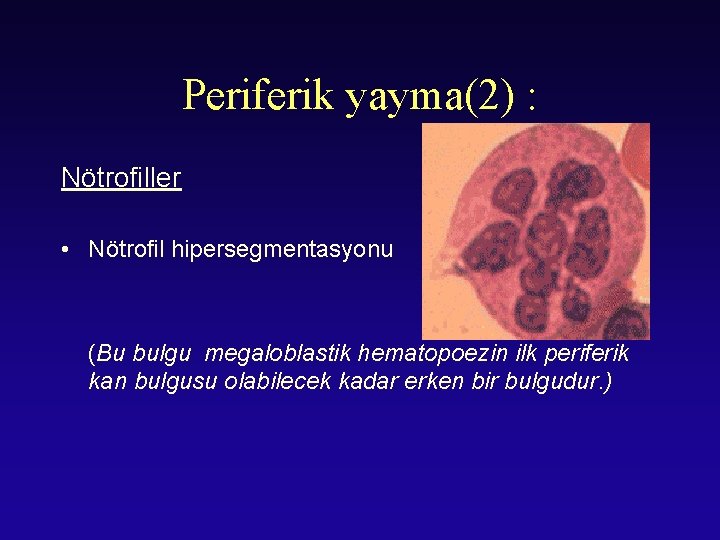 Periferik yayma(2) : Nötrofiller • Nötrofil hipersegmentasyonu (Bu bulgu megaloblastik hematopoezin ilk periferik kan