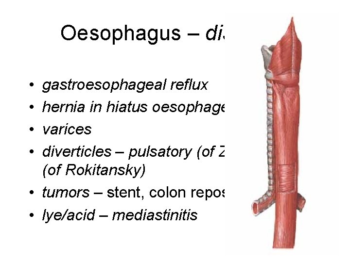 Oesophagus – diseases • • gastroesophageal reflux hernia in hiatus oesophageus varices diverticles –