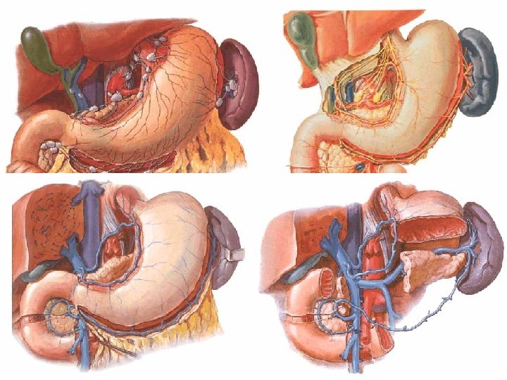 Stomach – other supply • Veins: correlate to arteries + v. prepylorica v. portae