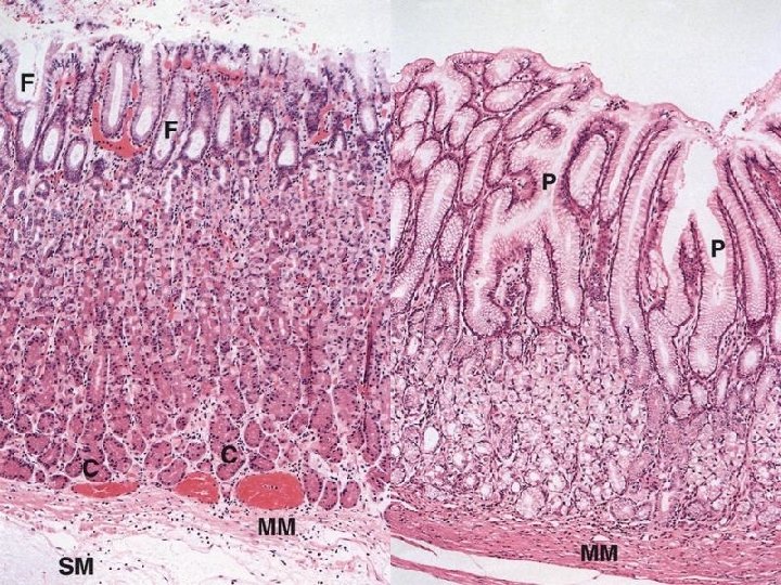 Tunica mucosa of gaster • gastric pits • deeper in pyloric part • glands