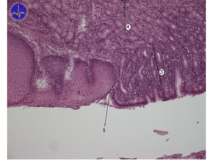 Cardia gastri - HE 