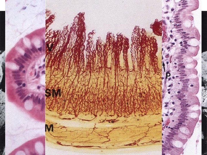 Villi intestinales • • • digit- to leaf-formed elements about 10 times surface enlargement