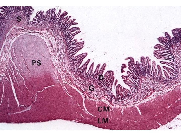 Transition: Pylorus - Duodenum HE 