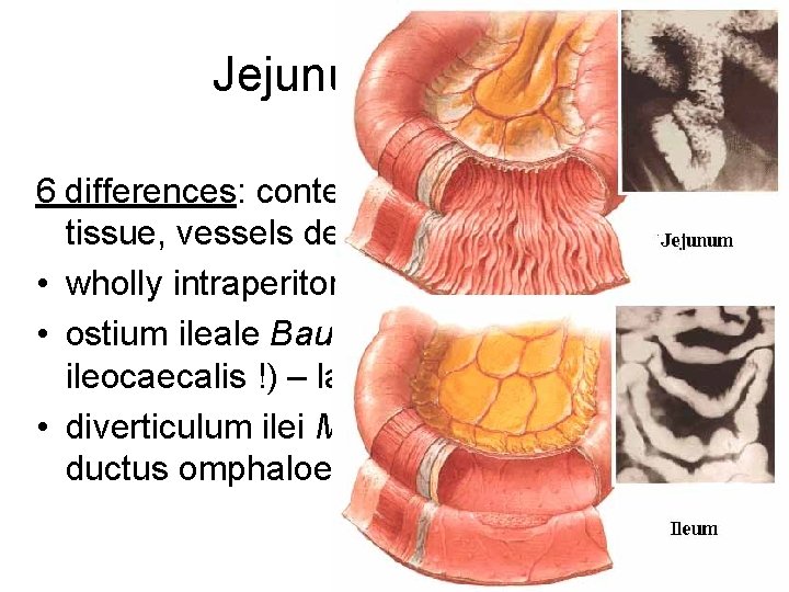 Jejunum et ileum 6 differences: content, width, folds, lymphoid tissue, vessels density and arrangement
