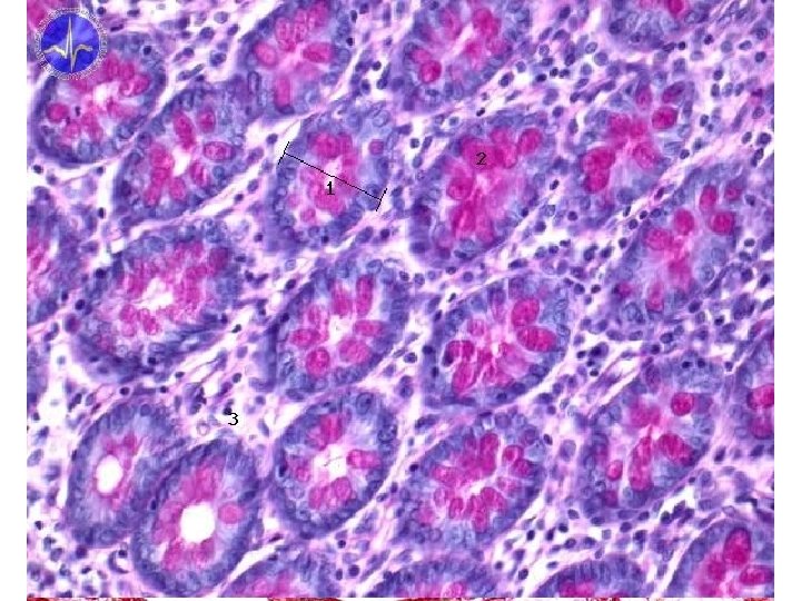 Large intestine - HE 