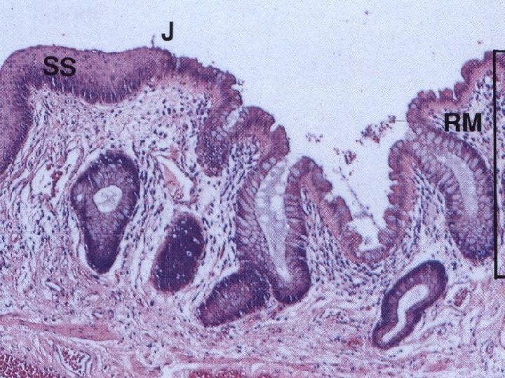 Canalis - structure • zona haemorrhoidalis - m. sphincter ani int. – columnae anales