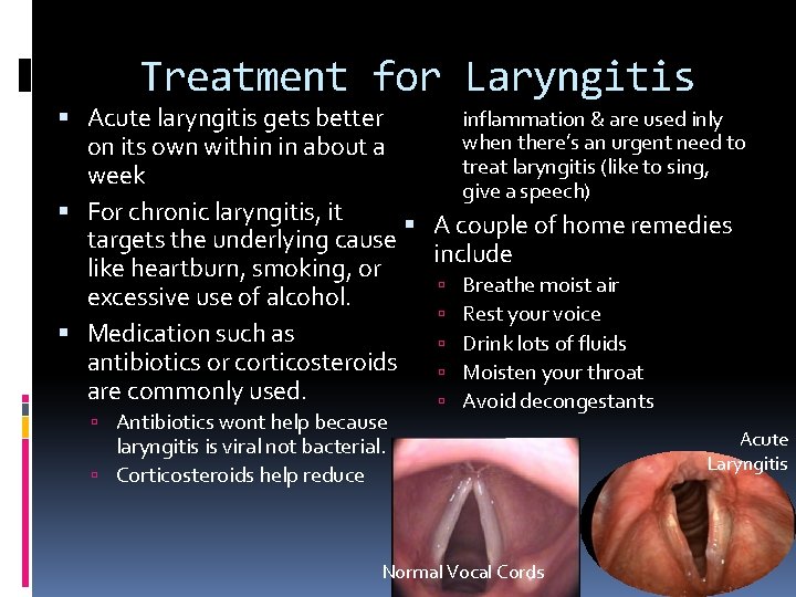 Treatment for Laryngitis inflammation & are used inly Acute laryngitis gets better when there’s