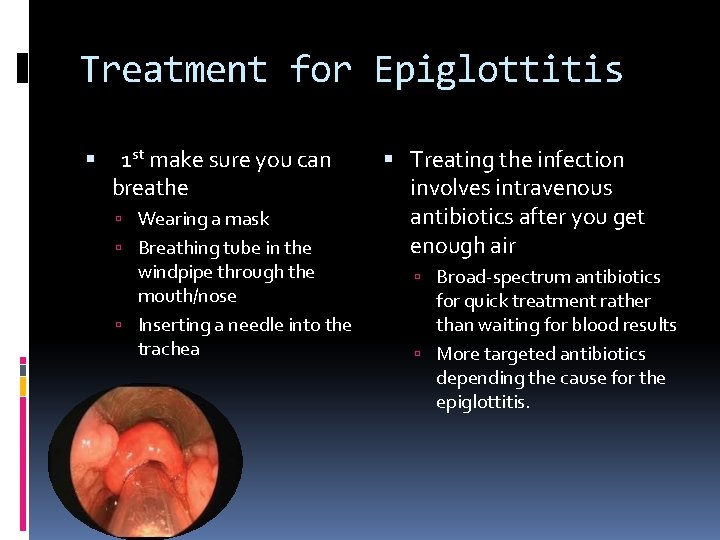 Treatment for Epiglottitis 1 st make sure you can breathe Wearing a mask Breathing