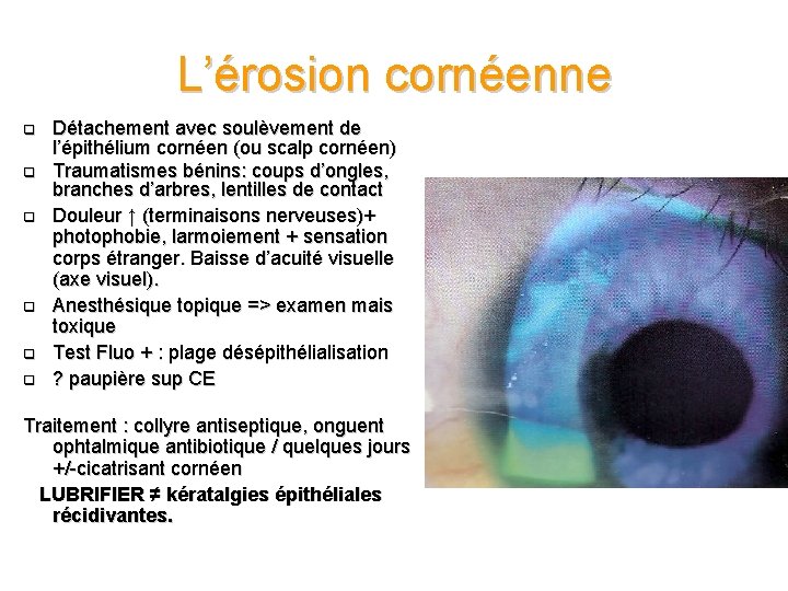 L’érosion cornéenne q q q Détachement avec soulèvement de l’épithélium cornéen (ou scalp cornéen)