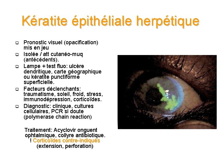 Kératite épithéliale herpétique q q q Pronostic visuel (opacification) mis en jeu Isolée /