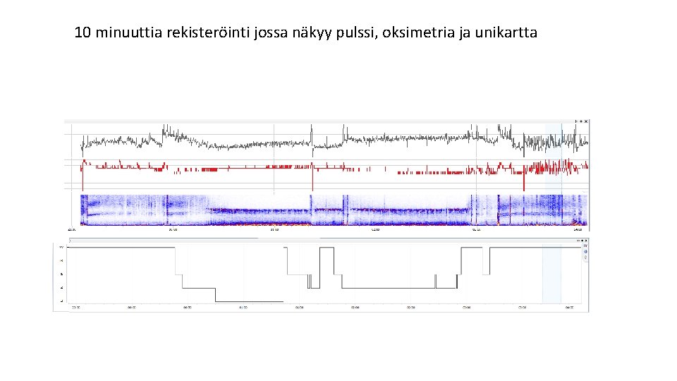 10 minuuttia rekisteröinti jossa näkyy pulssi, oksimetria ja unikartta 