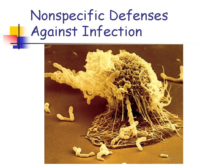 Nonspecific Defenses Against Infection 
