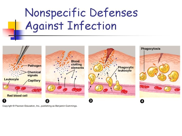Nonspecific Defenses Against Infection 