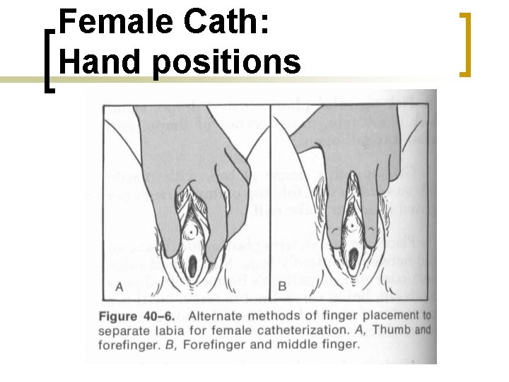 Female Cath: Hand positions 