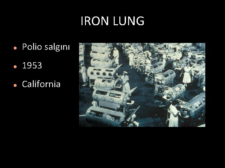 IRON LUNG Polio salgını 1953 California 