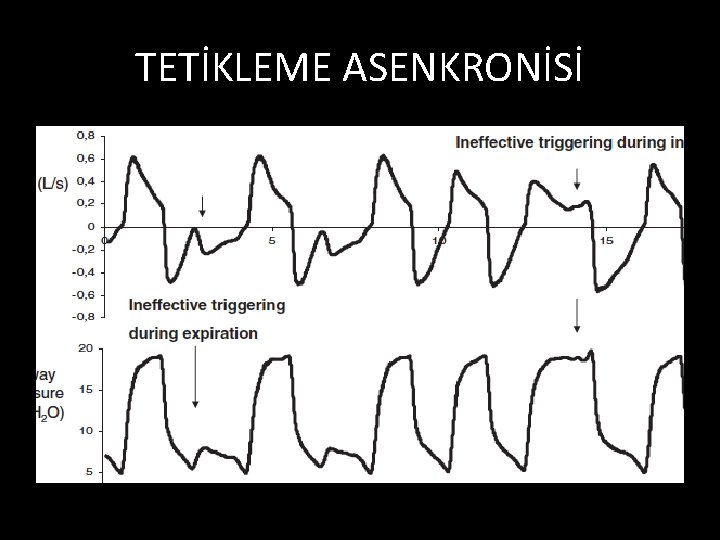 TETİKLEME ASENKRONİSİ 