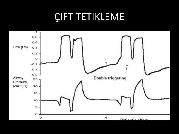 ÇIFT TETIKLEME 