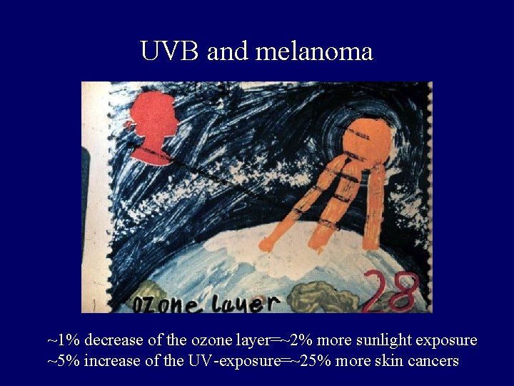 UVB and melanoma ~1% decrease of the ozone layer=~2% more sunlight exposure ~5% increase