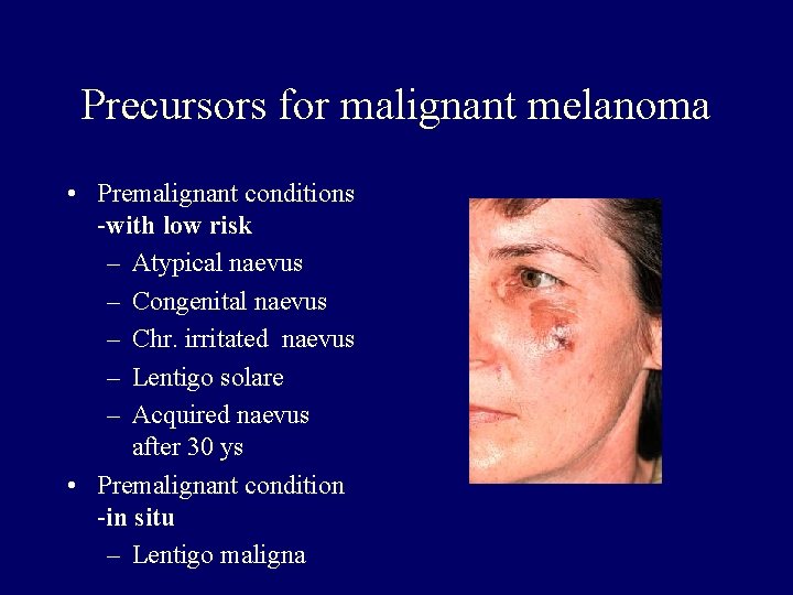 Precursors for malignant melanoma • Premalignant conditions -with low risk – Atypical naevus – Precursors for malignant melanoma • Premalignant conditions -with low risk – Atypical naevus –