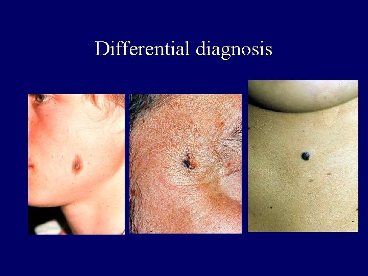 Differential diagnosis Differential diagnosis