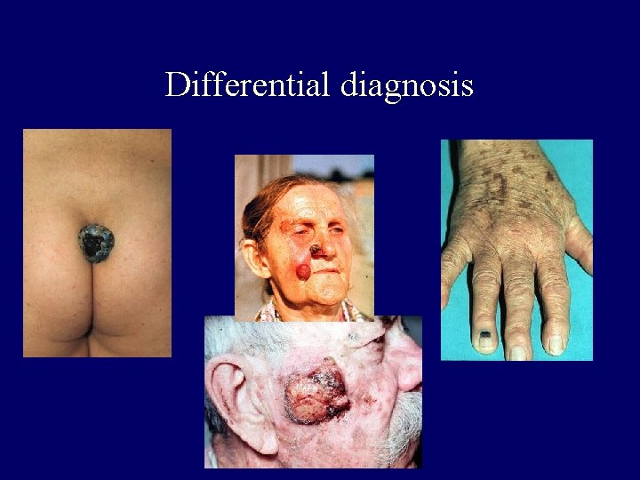 Differential diagnosis 