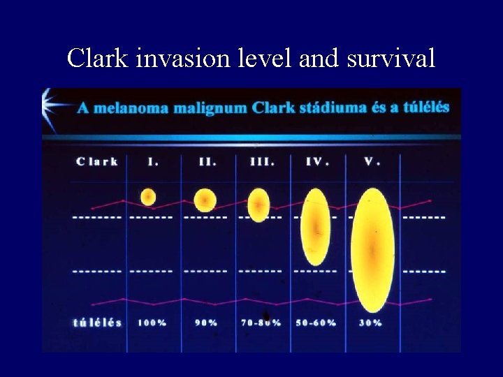 Clark invasion level and survival Clark invasion level and survival