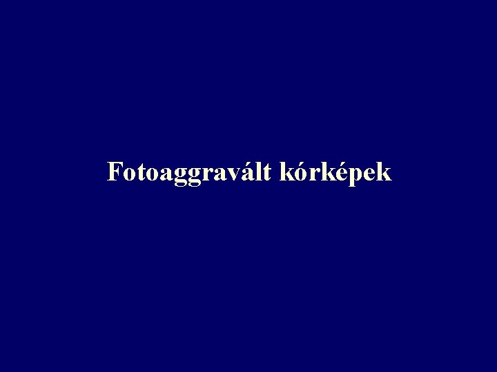 Fotoaggravált kórképek Fotoaggravált kórképek