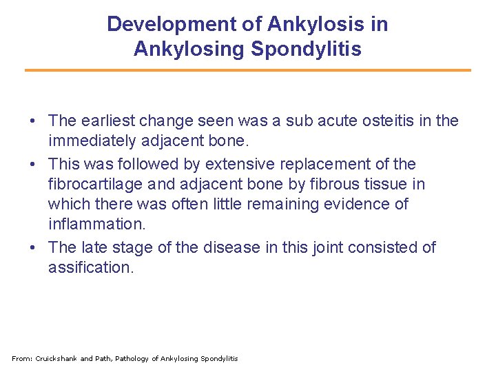 Development of Ankylosis in Ankylosing Spondylitis • The earliest change seen was a sub