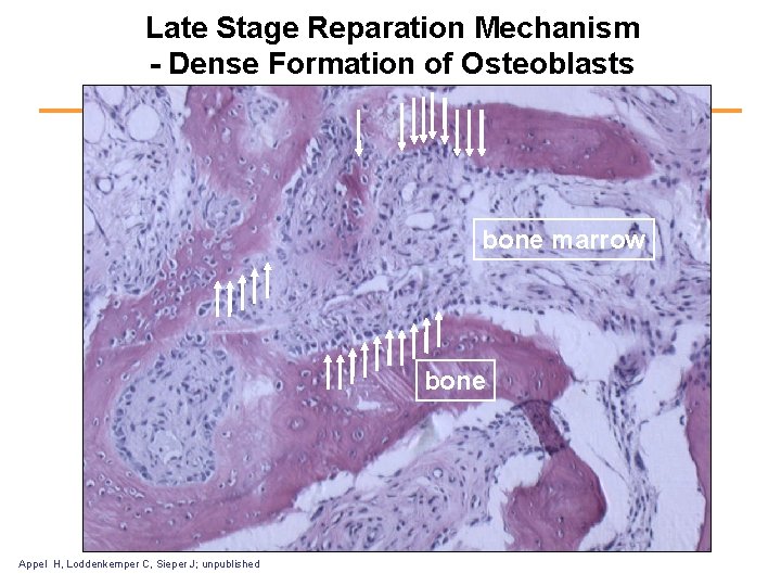 Late Stage Reparation Mechanism - Dense Formation of Osteoblasts bone marrow bone Appel H,