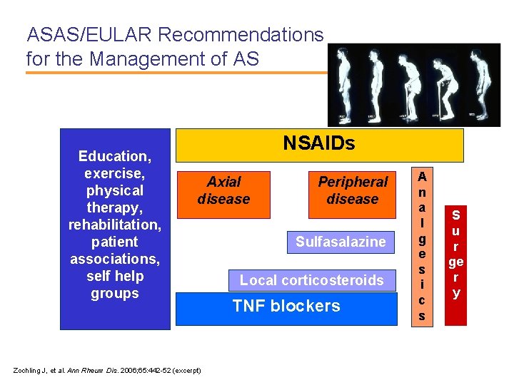 ASAS/EULAR Recommendations for the Management of AS Education, exercise, physical therapy, rehabilitation, patient associations,