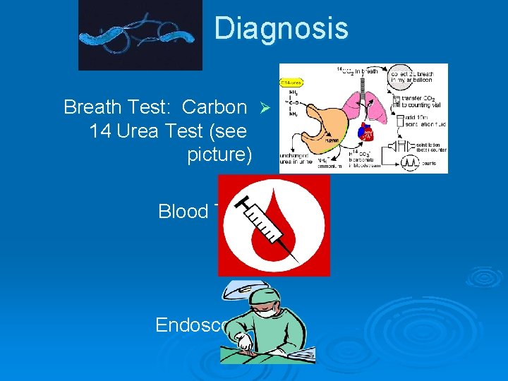 Diagnosis Breath Test: Carbon Ø 14 Urea Test (see picture) Blood Test Ø Endoscopy
