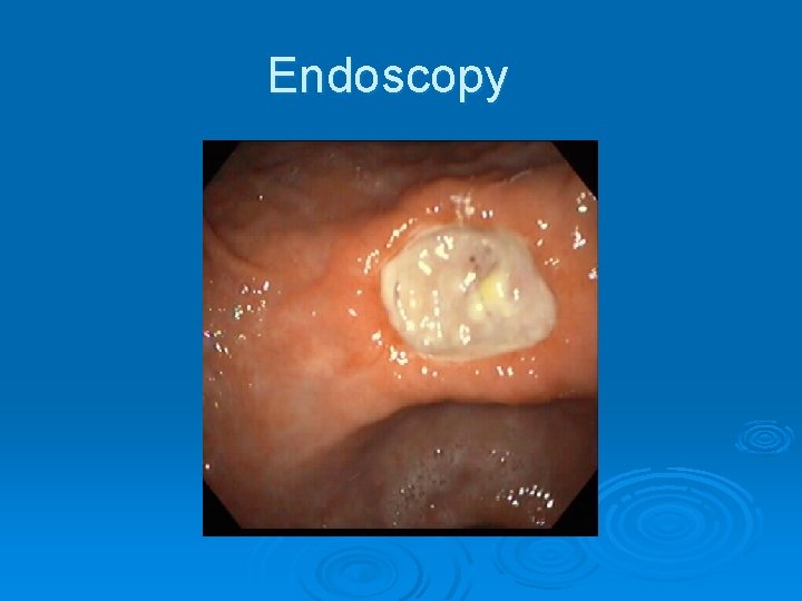 Endoscopy 