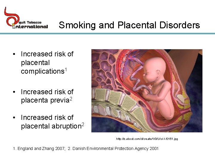 Smoking and Placental Disorders • Increased risk of placental complications 1 • Increased risk