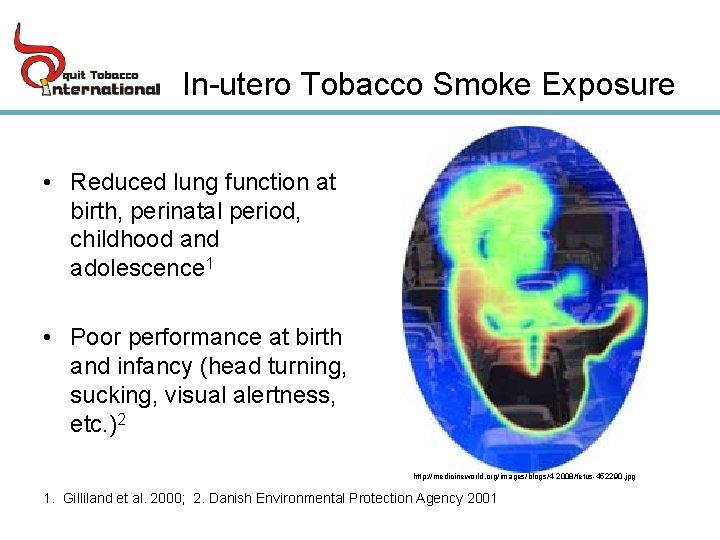 In-utero Tobacco Smoke Exposure • Reduced lung function at birth, perinatal period, childhood and
