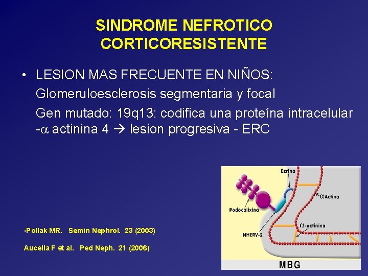 SINDROME NEFROTICO CORTICORESISTENTE • LESION MAS FRECUENTE EN NIÑOS: Glomeruloesclerosis segmentaria y focal Gen