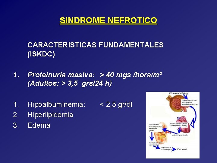 SINDROME NEFROTICO CARACTERISTICAS FUNDAMENTALES (ISKDC) 1. Proteinuria masiva: > 40 mgs /hora/m² (Adultos: >