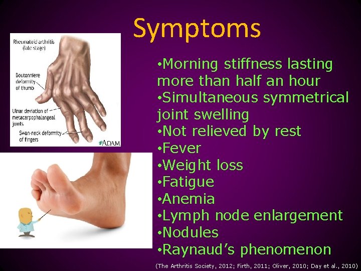 Symptoms • Morning stiffness lasting more than half an hour • Simultaneous symmetrical joint