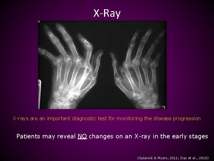 X-Ray X-rays are an important diagnostic test for monitoring the disease progression Patients may