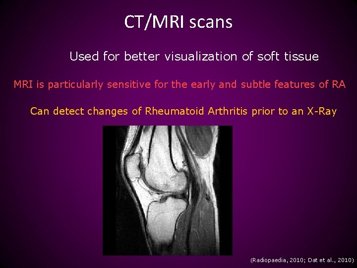 CT/MRI scans Used for better visualization of soft tissue MRI is particularly sensitive for