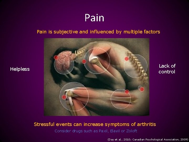 Pain is subjective and influenced by multiple factors Lack of control Helpless Stressful events