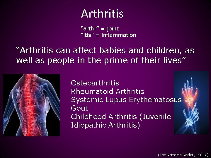 Arthritis “arthr” = joint “itis” = inflammation “Arthritis can affect babies and children, as