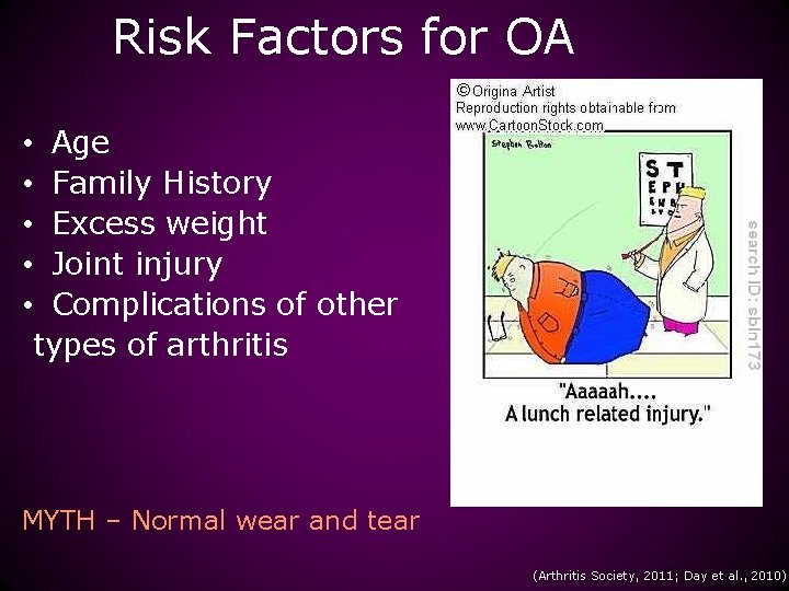 Risk Factors for OA • Age • Family History • Excess weight • Joint